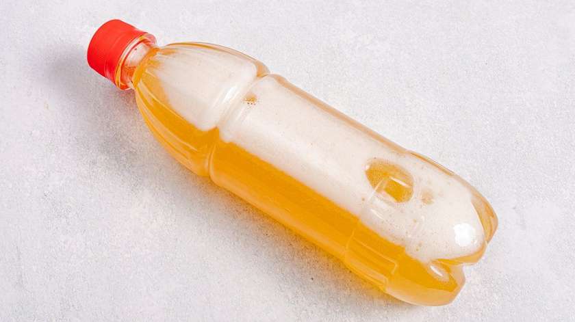 Xırdalan® 1 L